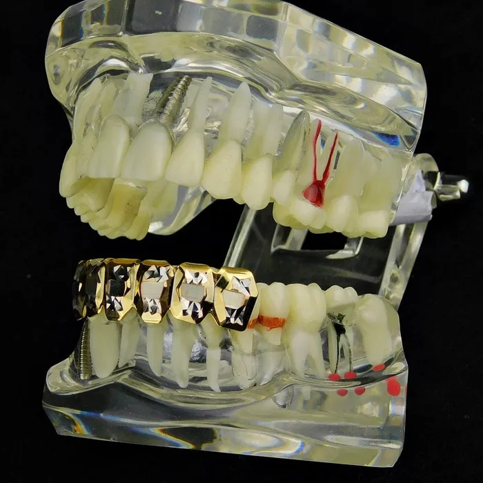 14K Gold Plated Deep DiamondCut Bottom Grillz Bling Cartel Admin Rings