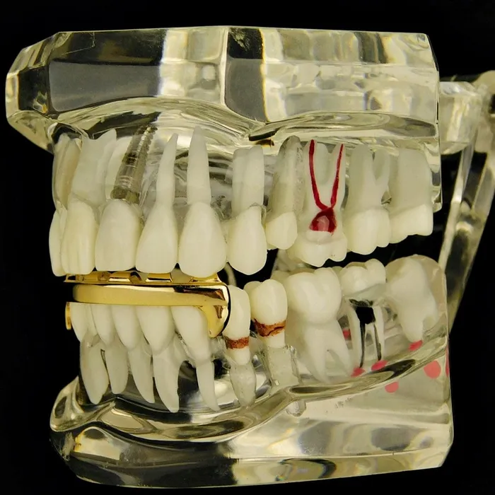 Bling Cartel Admin 14k Gold Plated Vampire Fangs Bar Bottom Grillz PreStyled Sets