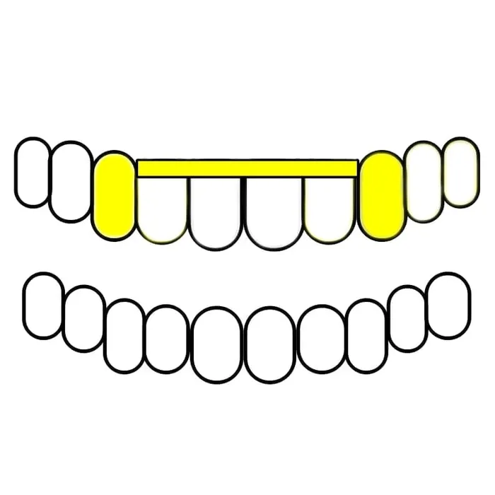 Bling Cartel Admin Rings Gold Plated over 925 Sterling Silver Canine Slim Front Bar Custom Grillz