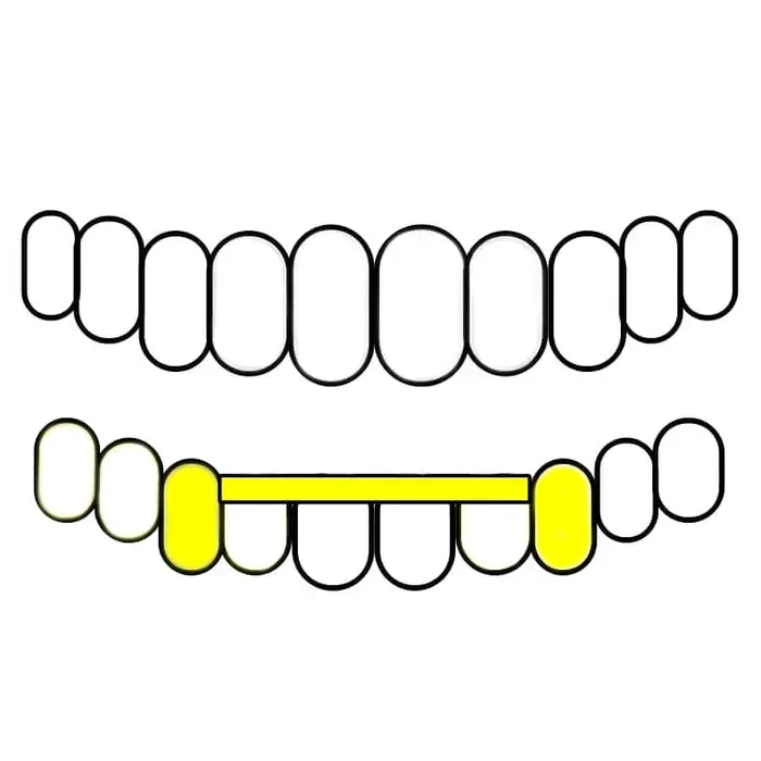 Bling Cartel Admin Rings Gold Plated over 925 Sterling Silver Canine Slim Front Bar Custom Grillz