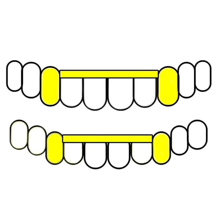 Bling Cartel Admin Rings Gold Plated over 925 Sterling Silver Canine Slim Front Bar Custom Grillz