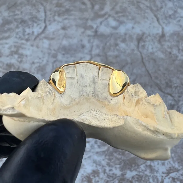 Bling Cartel Admin Rings Gold Plated over 925 Sterling Silver Canine Slim Front Bar Custom Grillz