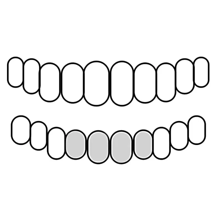 Bling Cartel Admin Rings Real 925 Sterling Silver Custom Grillz Diamond Dust Starburst Cuts Teeth Grill