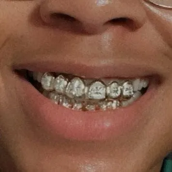 Bling Cartel Admin Rings Real 925 Sterling Silver Custom Grillz Diamond Dust Starburst Cuts Teeth Grill