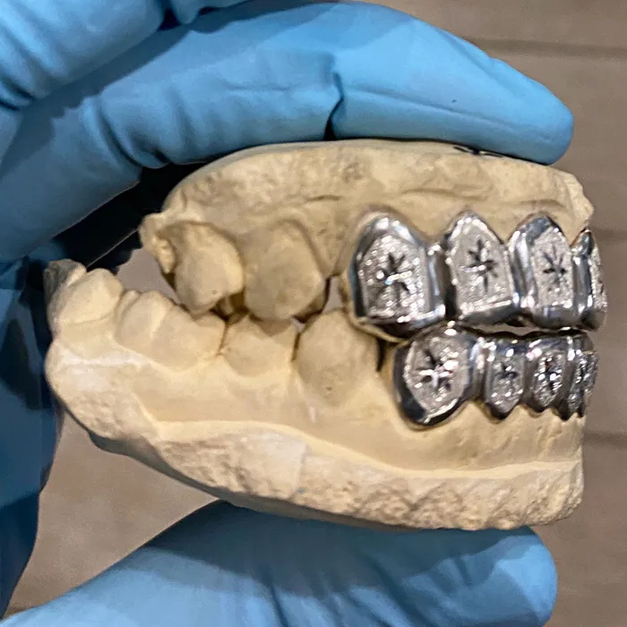Bling Cartel Admin Rings Real 925 Sterling Silver Custom Grillz Diamond Dust Starburst Cuts Teeth Grill