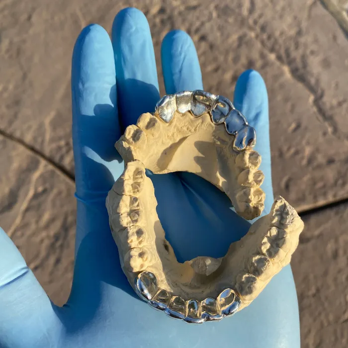 Bling Cartel Admin Rings Real 925 Sterling Silver Custom Grillz Diamond Dust Starburst Cuts Teeth Grill