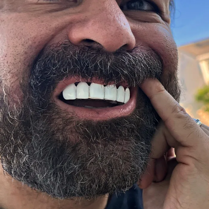 Rings Bling Cartel Real Solid 925 Sterling Silver White Enamel Top Six Teeth Grillz Rings Bling Cartel Real Solid 925 Sterling Silver White Enamel Top Six Teeth Grillz