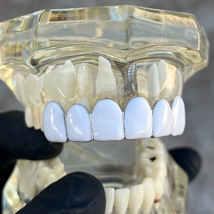 Rings Bling Cartel Real Solid 925 Sterling Silver White Enamel Top Six Teeth Grillz Rings Bling Cartel Real Solid 925 Sterling Silver White Enamel Top Six Teeth Grillz