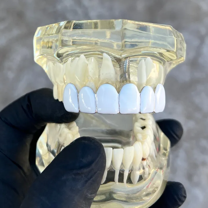 Rings Bling Cartel Real Solid 925 Sterling Silver White Enamel Top Six Teeth Grillz Rings Bling Cartel Real Solid 925 Sterling Silver White Enamel Top Six Teeth Grillz