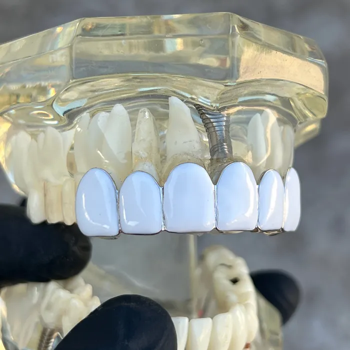 Rings Bling Cartel Real Solid 925 Sterling Silver White Enamel Top Six Teeth Grillz Rings Bling Cartel Real Solid 925 Sterling Silver White Enamel Top Six Teeth Grillz