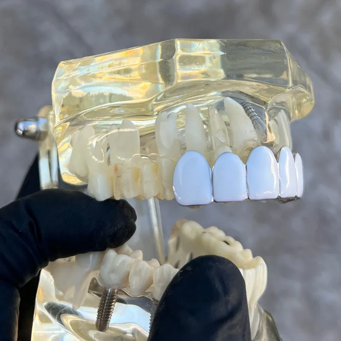 Rings Bling Cartel Real Solid 925 Sterling Silver White Enamel Top Six Teeth Grillz Rings Bling Cartel Real Solid 925 Sterling Silver White Enamel Top Six Teeth Grillz