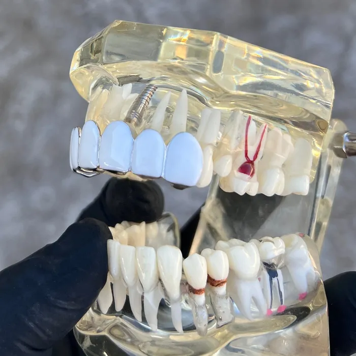 Rings Bling Cartel Real Solid 925 Sterling Silver White Enamel Top Six Teeth Grillz Rings Bling Cartel Real Solid 925 Sterling Silver White Enamel Top Six Teeth Grillz