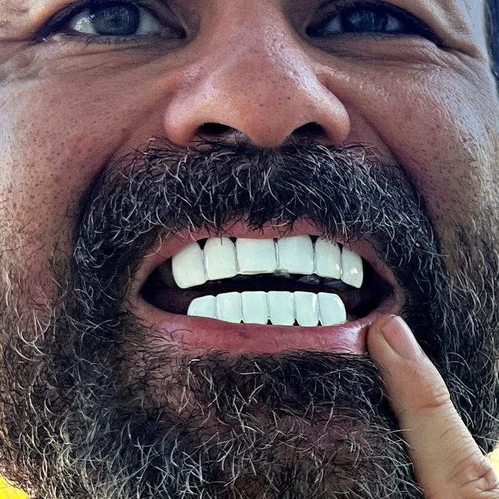 Rings Real Solid 925 Sterling Silver White Enamel Top and Bottom Teeth Grillz Set Bling Cartel Rings Real Solid 925 Sterling Silver White Enamel Top and Bottom Teeth Grillz Set Bling Cartel