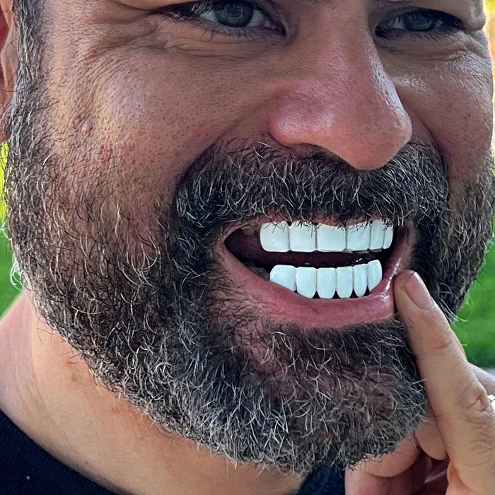 Rings Real Solid 925 Sterling Silver White Enamel Top and Bottom Teeth Grillz Set Bling Cartel Rings Real Solid 925 Sterling Silver White Enamel Top and Bottom Teeth Grillz Set Bling Cartel